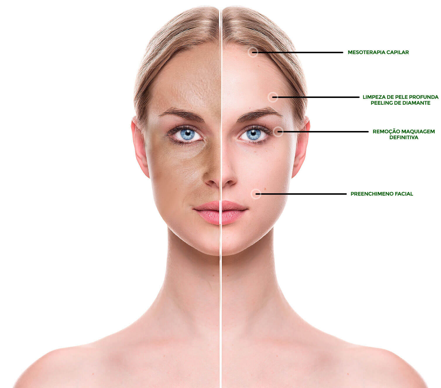 Beneficios Preenchimento Facial