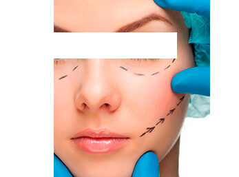 Como fazer preenchimento facial botox